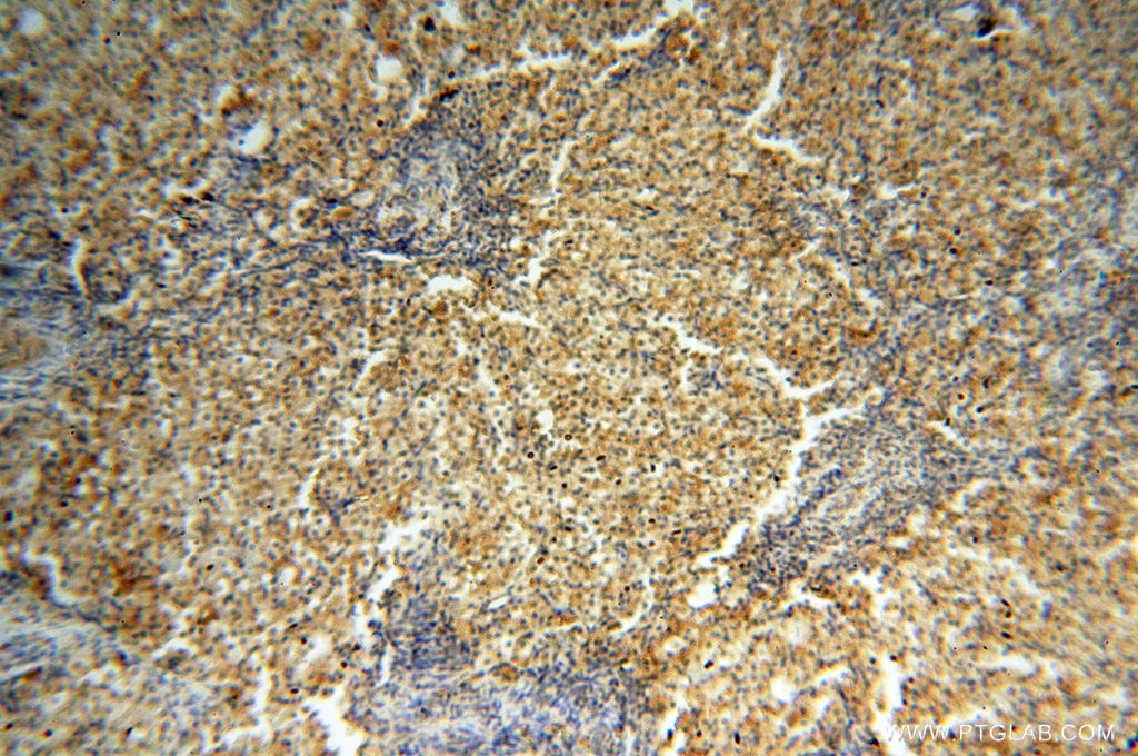 Immunohistochemistry (IHC) staining of human ovary tissue using CSK Polyclonal antibody (17720-1-AP)