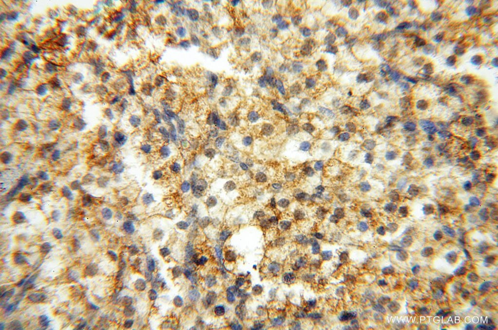 Immunohistochemistry (IHC) staining of human ovary tissue using CSK Polyclonal antibody (17720-1-AP)