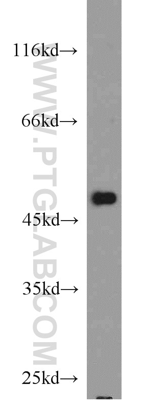 Western Blot (WB) analysis of HL-60 cells using CSK Polyclonal antibody (17720-1-AP)