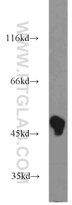 Western Blot (WB) analysis of Jurkat cells using CSK Polyclonal antibody (17720-1-AP)