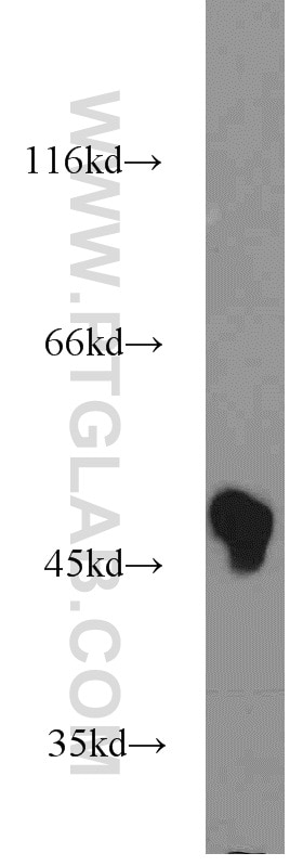 WB analysis of Jurkat using 17720-1-AP