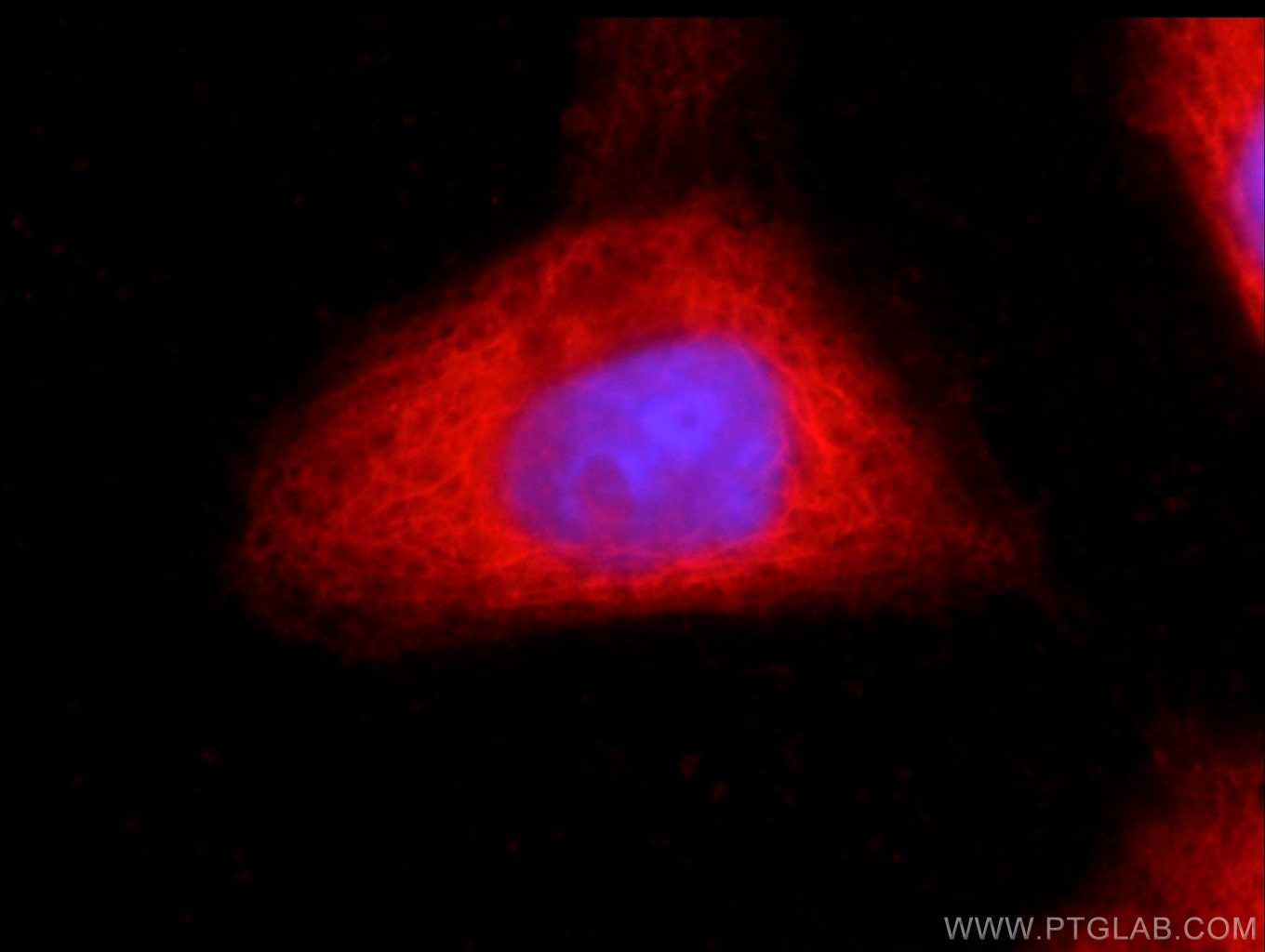 Immunofluorescence (IF) / fluorescent staining of A431 cells using CSK Monoclonal antibody (66115-1-Ig)