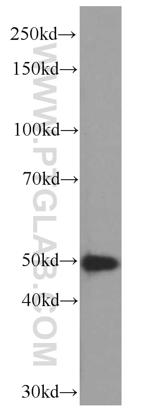 Western Blot (WB) analysis of Jurkat cells using CSK Monoclonal antibody (66115-1-Ig)
