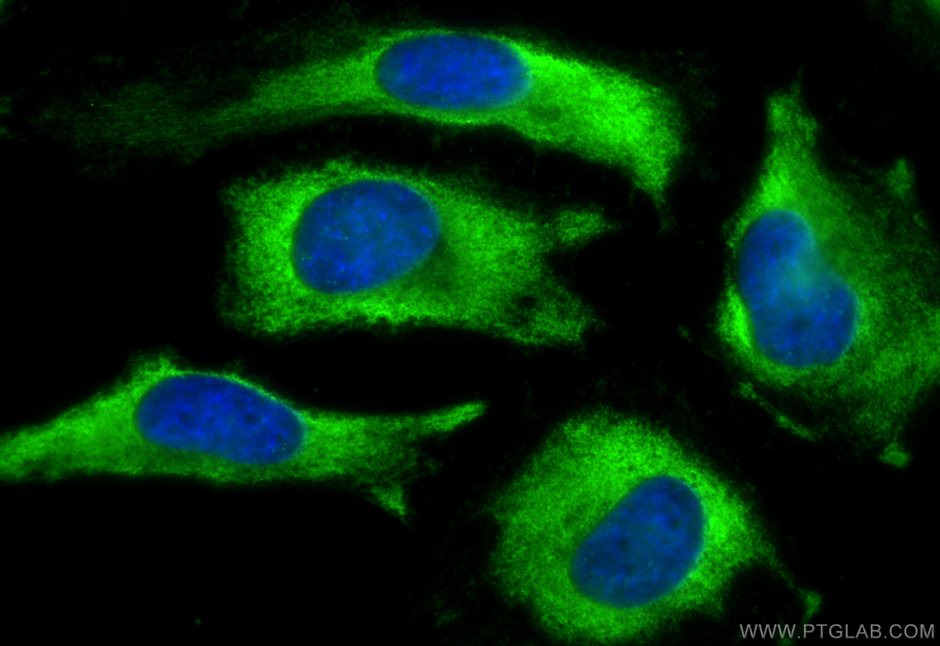 Immunofluorescence (IF) / fluorescent staining of HeLa cells using CoraLite® Plus 488-conjugated CSK Monoclonal antib (CL488-66115)