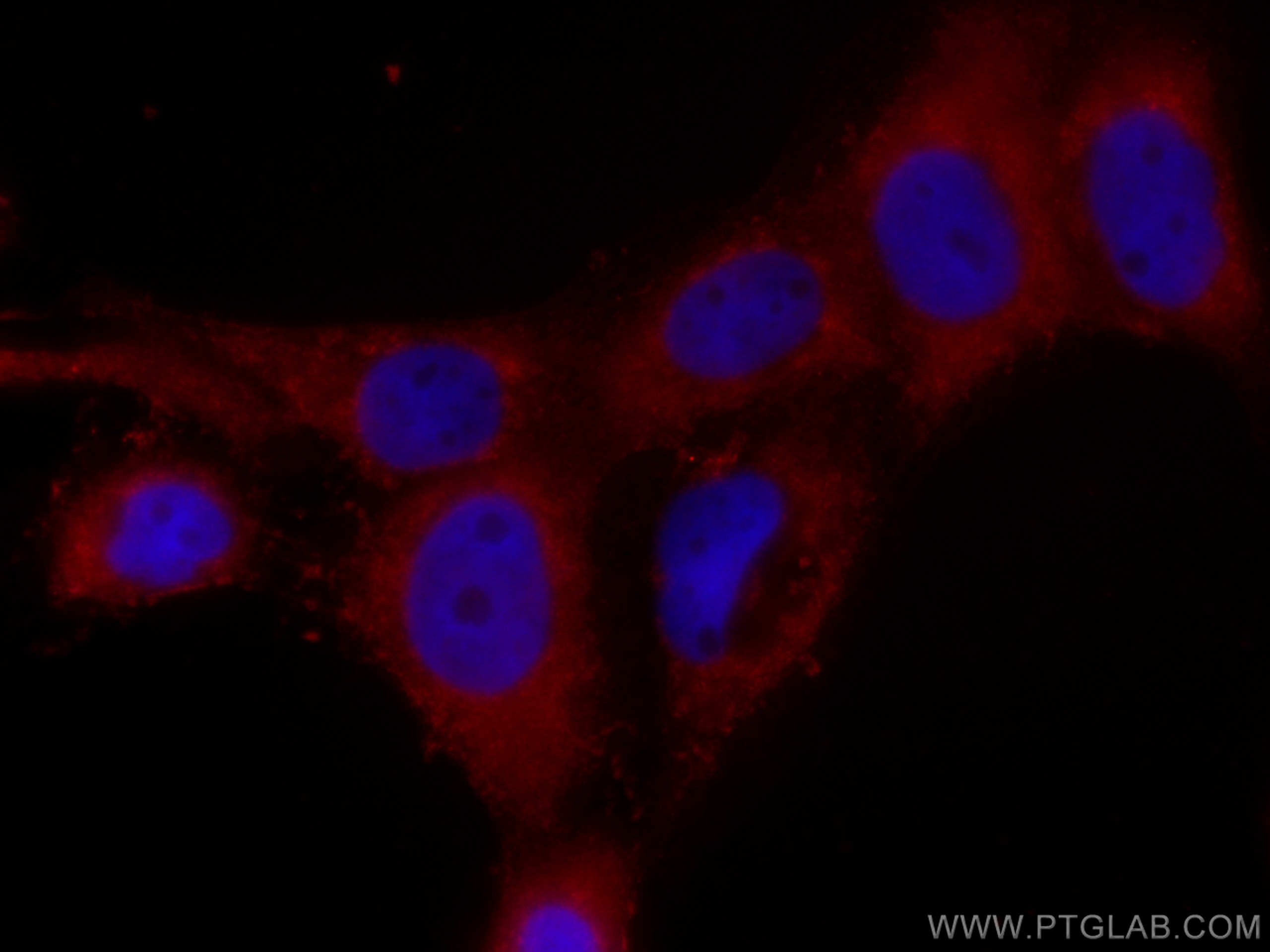 Immunofluorescence (IF) / fluorescent staining of A431 cells using CoraLite®594-conjugated CSK Monoclonal antibody (CL594-66115)