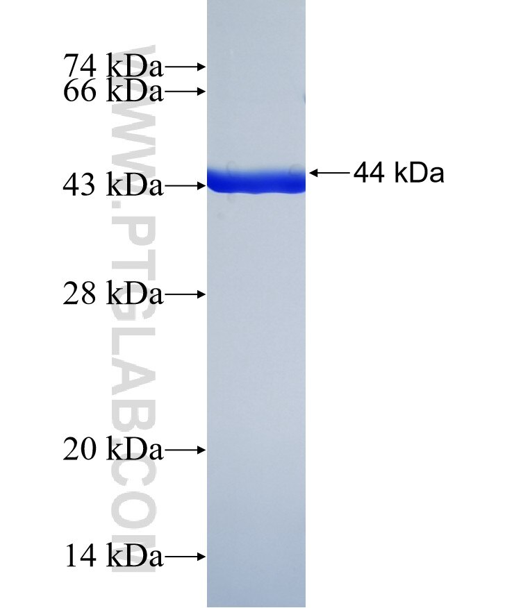 CSMD1 fusion protein Ag39219 SDS-PAGE