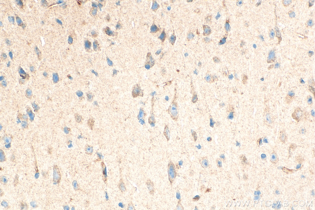 Immunohistochemical analysis of paraffin-embedded mouse brain tissue slide using 31573-1-AP (CSMD2 antibody) at dilution of 1:200 (under 40x lens). Heat mediated antigen retrieval with Tris-EDTA buffer (pH 9.0). Immunohistochemistry (IHC) staining of mouse brain tissue using CSMD2 Polyclonal antibody (31573-1-AP)