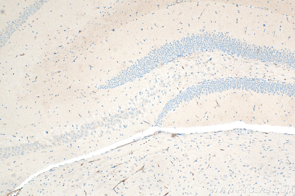 Immunohistochemical analysis of paraffin-embedded mouse brain tissue slide using 31573-1-AP (CSMD2 antibody) at dilution of 1:200 (under 10x lens). Heat mediated antigen retrieval with Tris-EDTA buffer (pH 9.0). Immunohistochemistry (IHC) staining of mouse brain tissue using CSMD2 Polyclonal antibody (31573-1-AP)