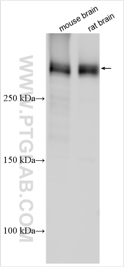 Western Blot (WB) analysis of various lysates using CSMD2 Polyclonal antibody (31573-1-AP)