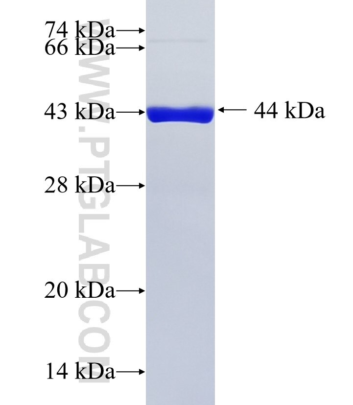 CSMD2 fusion protein Ag36106 SDS-PAGE