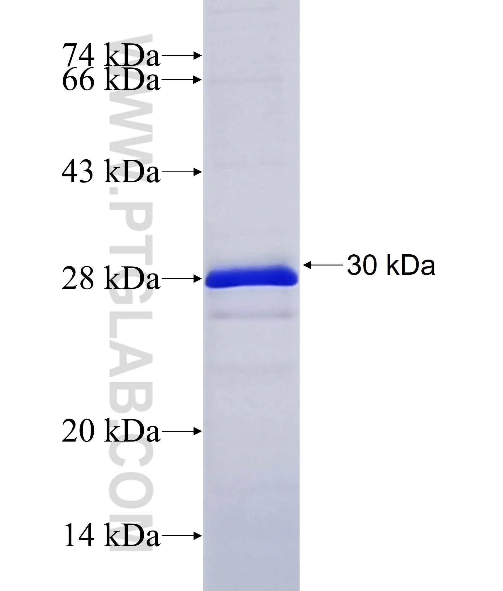 CSMD3 fusion protein Ag38030 SDS-PAGE