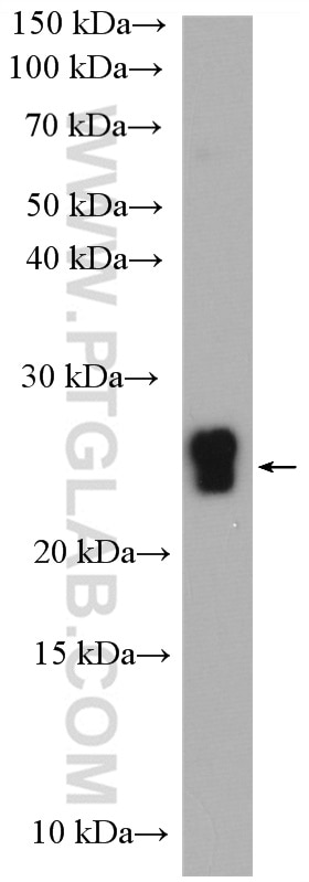 Western Blot (WB) analysis of human milk using CSN1S1 Polyclonal antibody (22648-1-AP)