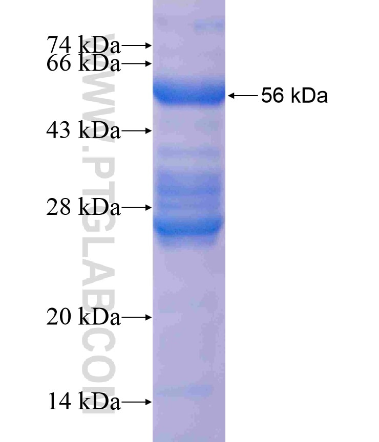 CSN1S1 fusion protein Ag18529 SDS-PAGE