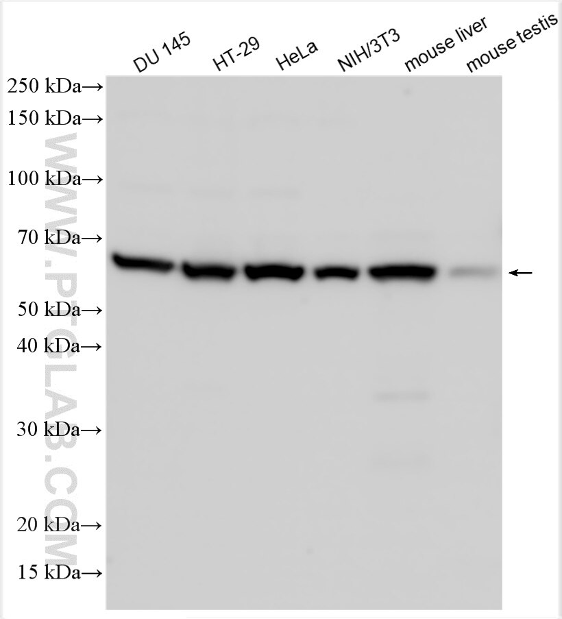 Western Blot (WB) analysis of various lysates using CSN2 Polyclonal antibody (30498-1-AP)