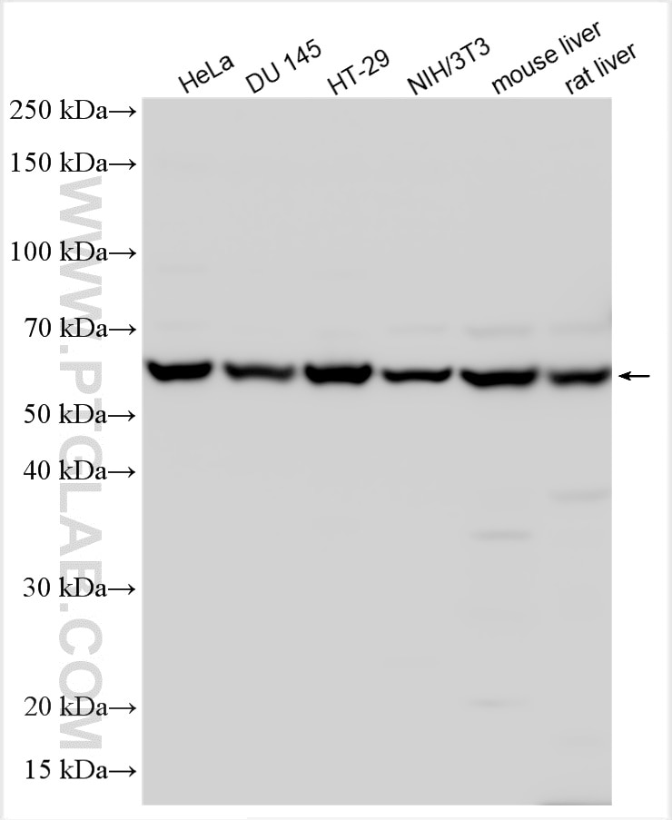 Western Blot (WB) analysis of various lysates using CSN2 Polyclonal antibody (30498-1-AP)