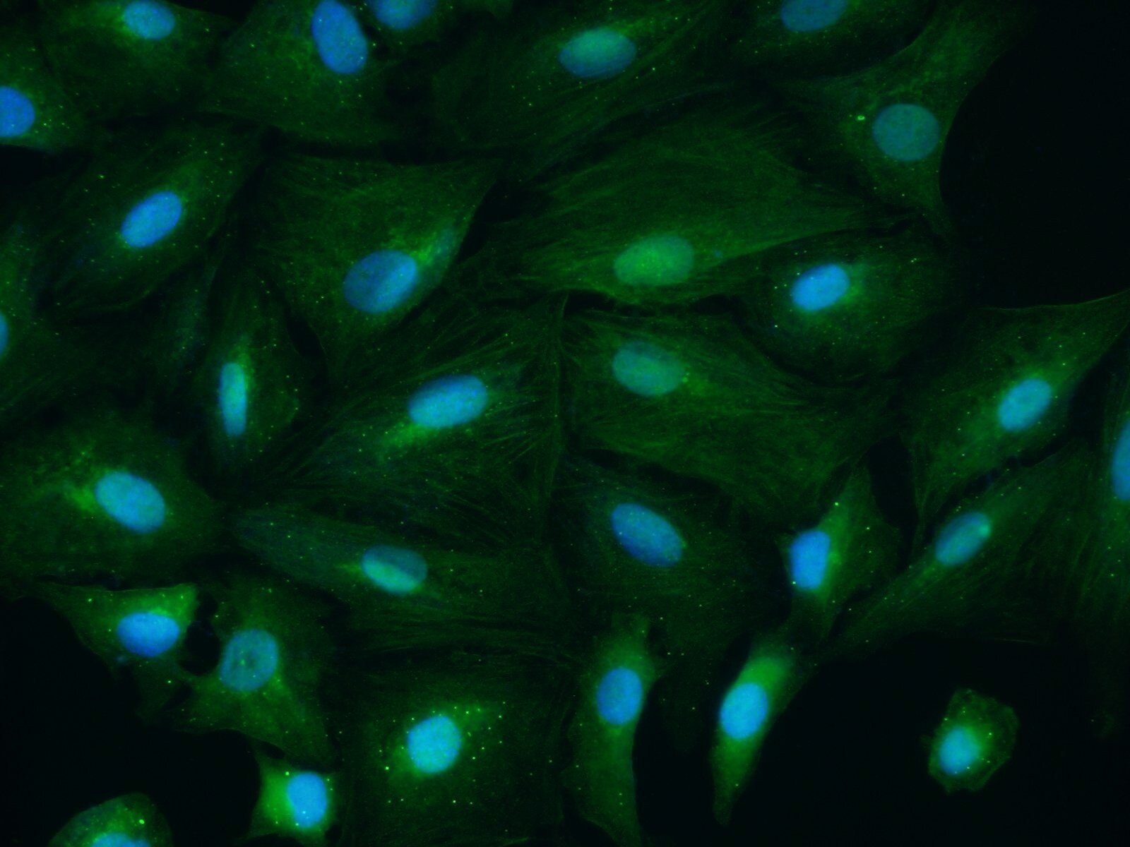 Immunofluorescence (IF) / fluorescent staining of A549 cells using CSNK1A1 Polyclonal antibody (55192-1-AP)