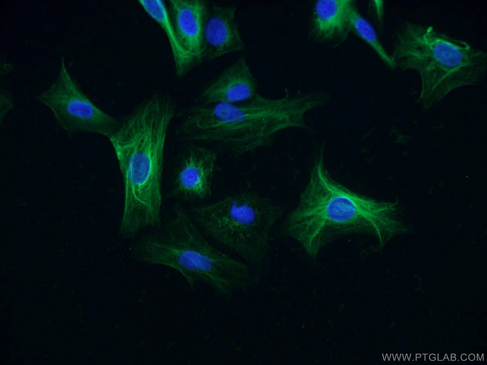 Immunofluorescence (IF) / fluorescent staining of A549 cells using CSNK1A1 Polyclonal antibody (55192-1-AP)
