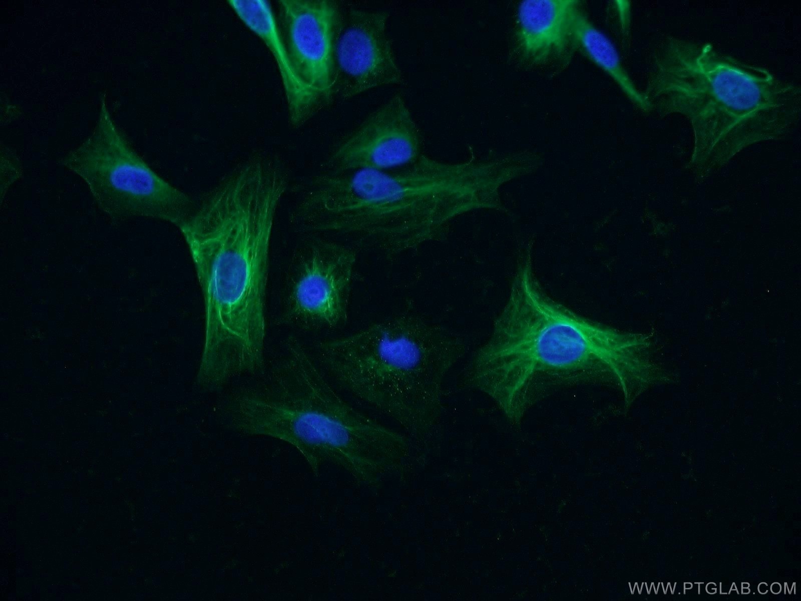 IF Staining of A549 using 55192-1-AP