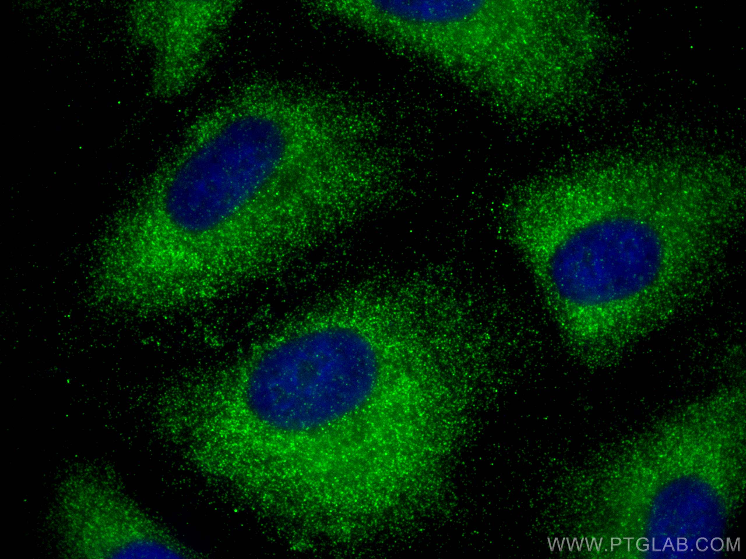 Immunofluorescence (IF) / fluorescent staining of A549 cells using CSNK1A1 Polyclonal antibody (55192-1-AP)