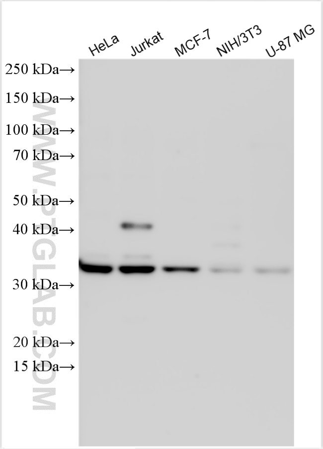 Western Blot (WB) analysis of various lysates using CSNK1A1 Polyclonal antibody (55192-1-AP)