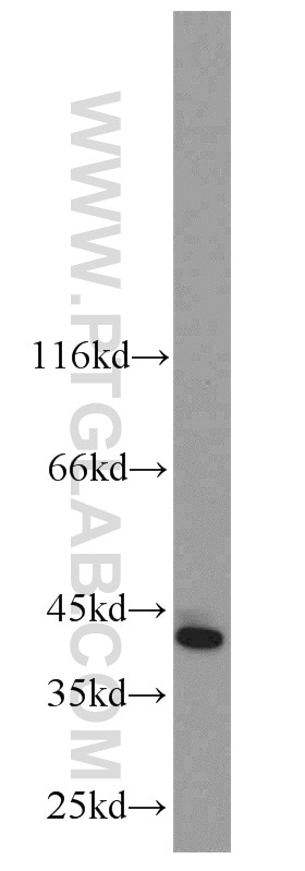 WB analysis of MCF-7 using 55192-1-AP