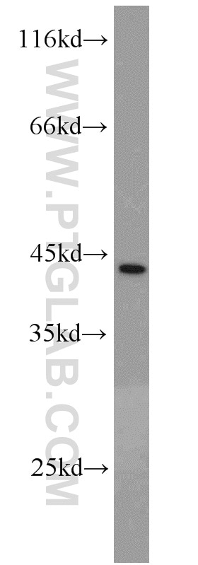 Western Blot (WB) analysis of HeLa cells using CSNK1A1 Polyclonal antibody (55192-1-AP)