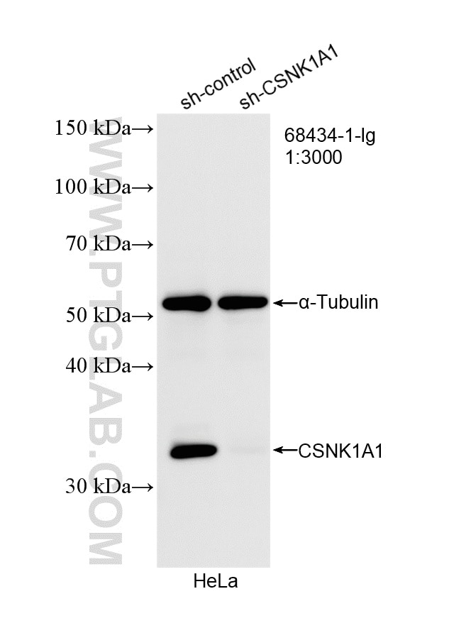 Western Blot (WB) analysis of HeLa cells using CSNK1A1 Monoclonal antibody (68434-1-Ig)