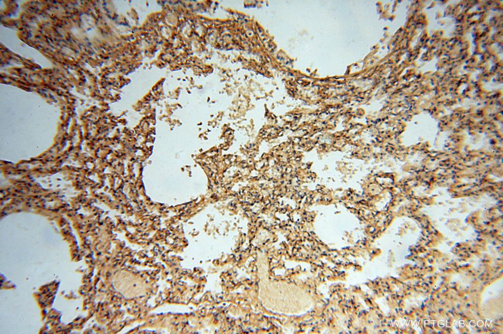 IHC staining of human lung using 17125-1-AP