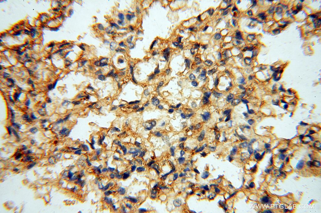 Immunohistochemistry (IHC) staining of human lung tissue using CSNK1A1L Polyclonal antibody (17125-1-AP)