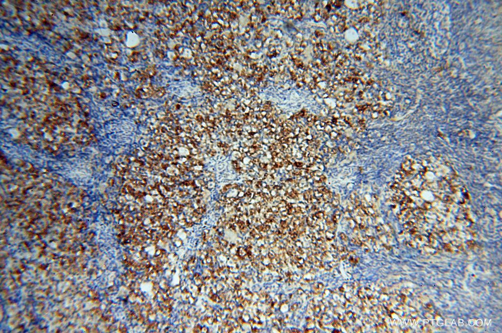 Immunohistochemistry (IHC) staining of human ovary tissue using CSNK1A1L Polyclonal antibody (17125-1-AP)