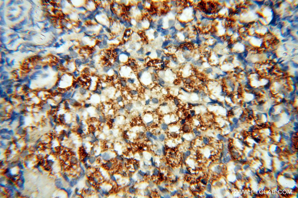 Immunohistochemistry (IHC) staining of human ovary tissue using CSNK1A1L Polyclonal antibody (17125-1-AP)