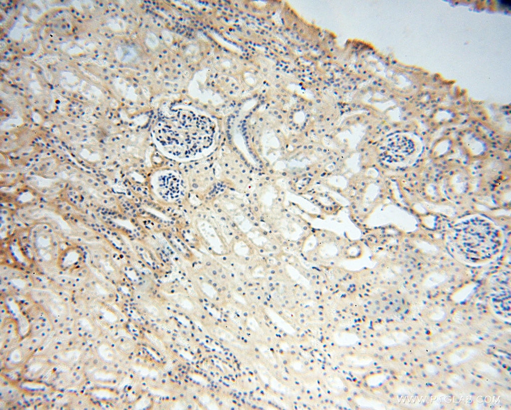 Immunohistochemistry (IHC) staining of human kidney tissue using CSNK1A1L Polyclonal antibody (17125-1-AP)