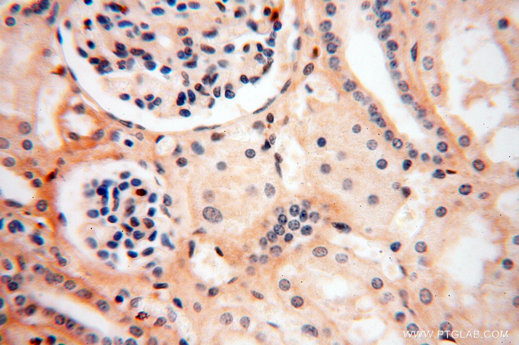 Immunohistochemistry (IHC) staining of human kidney tissue using CSNK1A1L Polyclonal antibody (17125-1-AP)