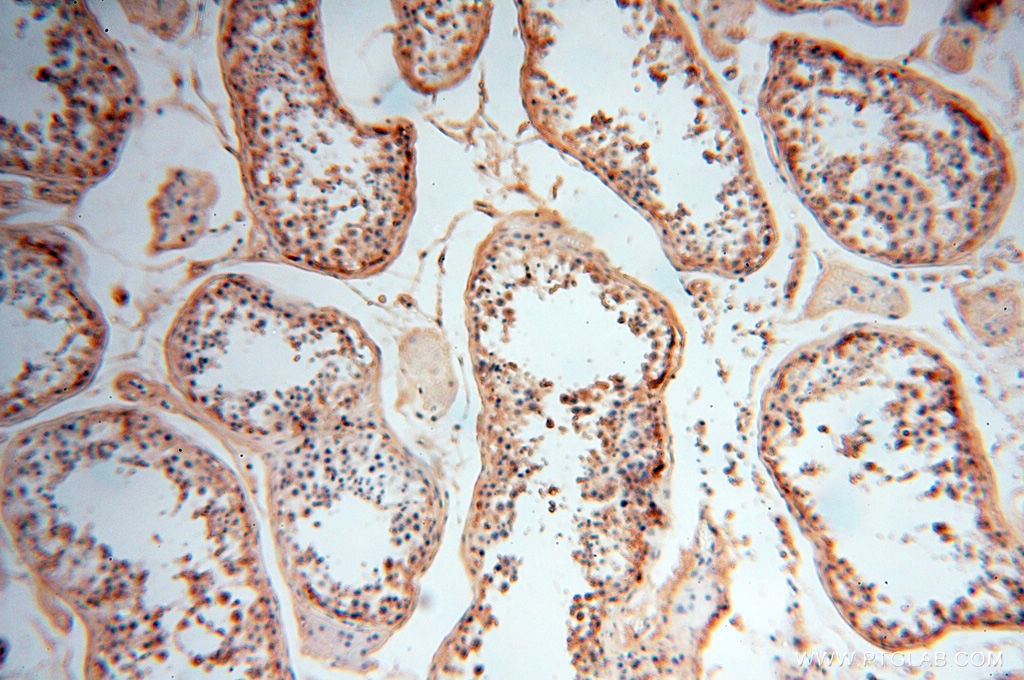 Immunohistochemistry (IHC) staining of human testis tissue using CSNK1A1L Polyclonal antibody (17125-1-AP)