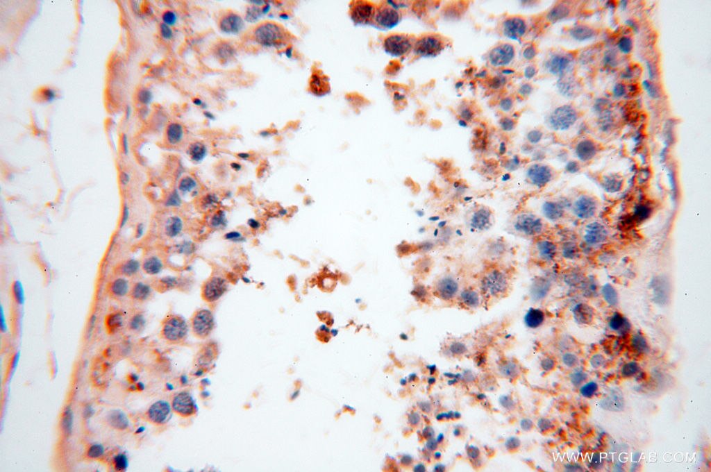 Immunohistochemistry (IHC) staining of human testis tissue using CSNK1A1L Polyclonal antibody (17125-1-AP)
