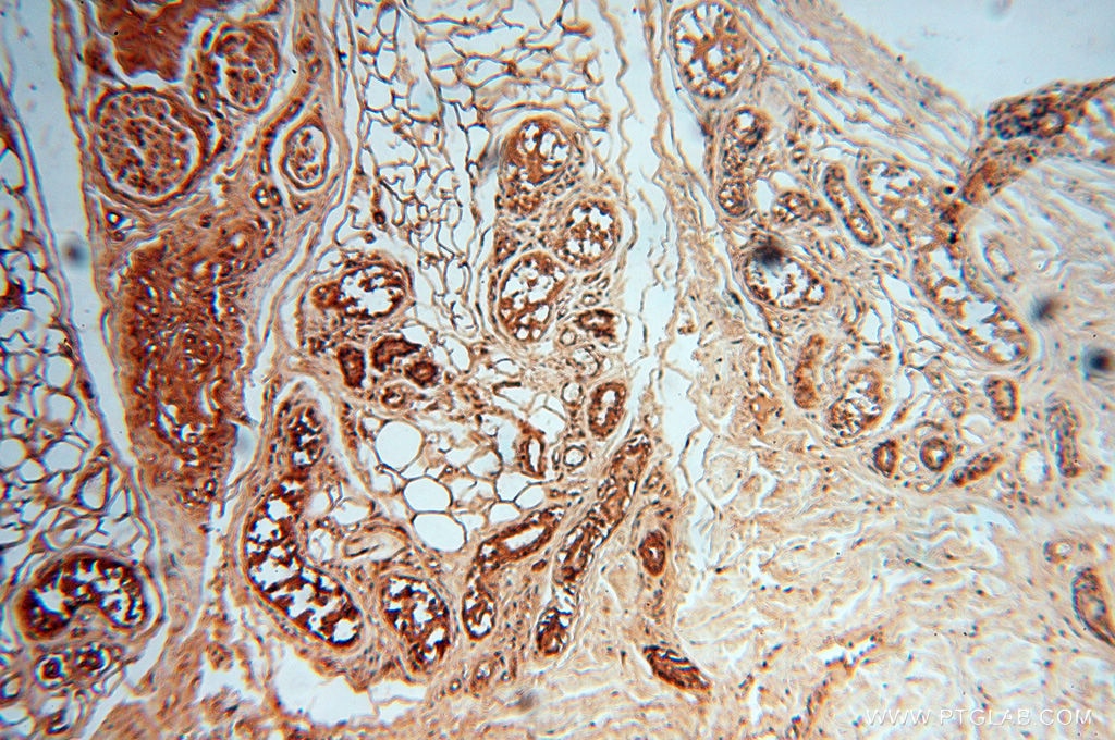 Immunohistochemistry (IHC) staining of human skin tissue using CSNK1A1L Polyclonal antibody (17125-1-AP)