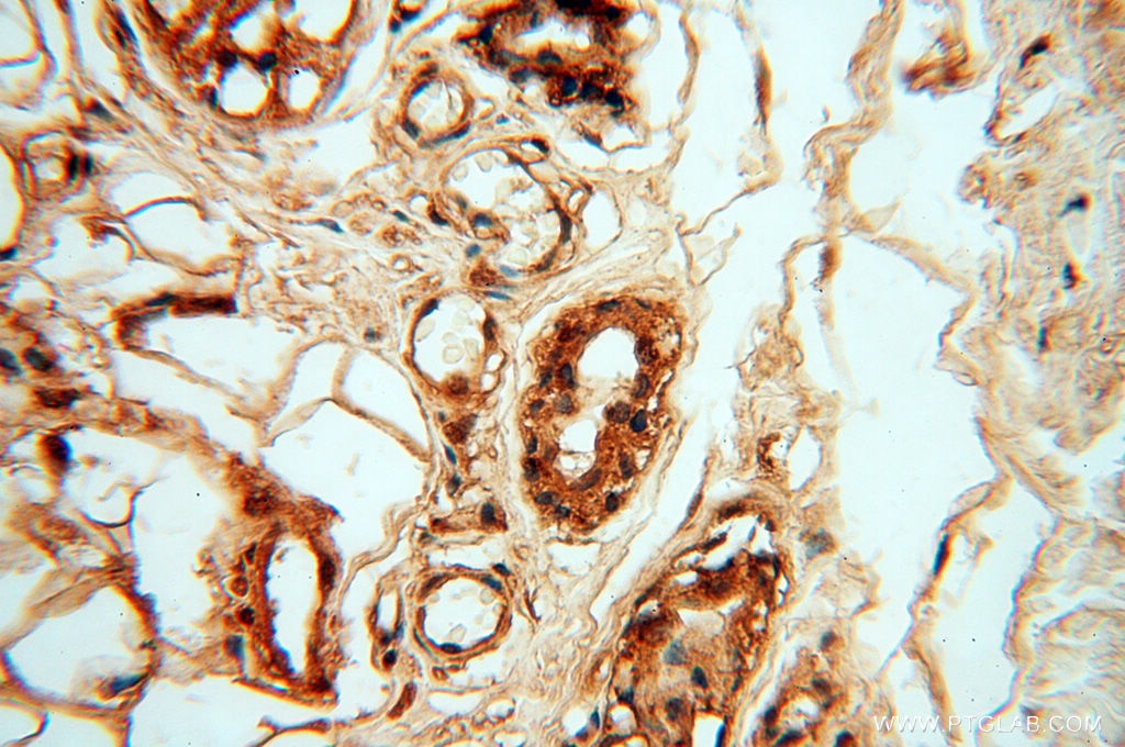 Immunohistochemistry (IHC) staining of human skin tissue using CSNK1A1L Polyclonal antibody (17125-1-AP)