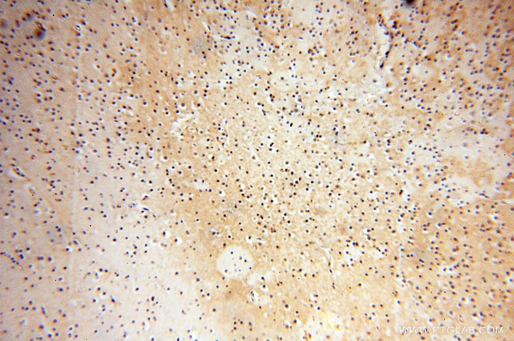 Immunohistochemistry (IHC) staining of human brain tissue using CSNK1A1L Polyclonal antibody (17125-1-AP)