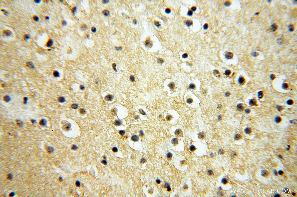 Immunohistochemistry (IHC) staining of human brain tissue using CSNK1A1L Polyclonal antibody (17125-1-AP)