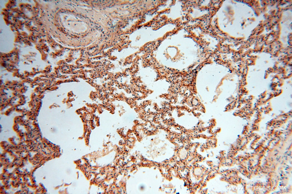 Immunohistochemistry (IHC) staining of human lung tissue using CSNK1A1L Polyclonal antibody (17125-1-AP)