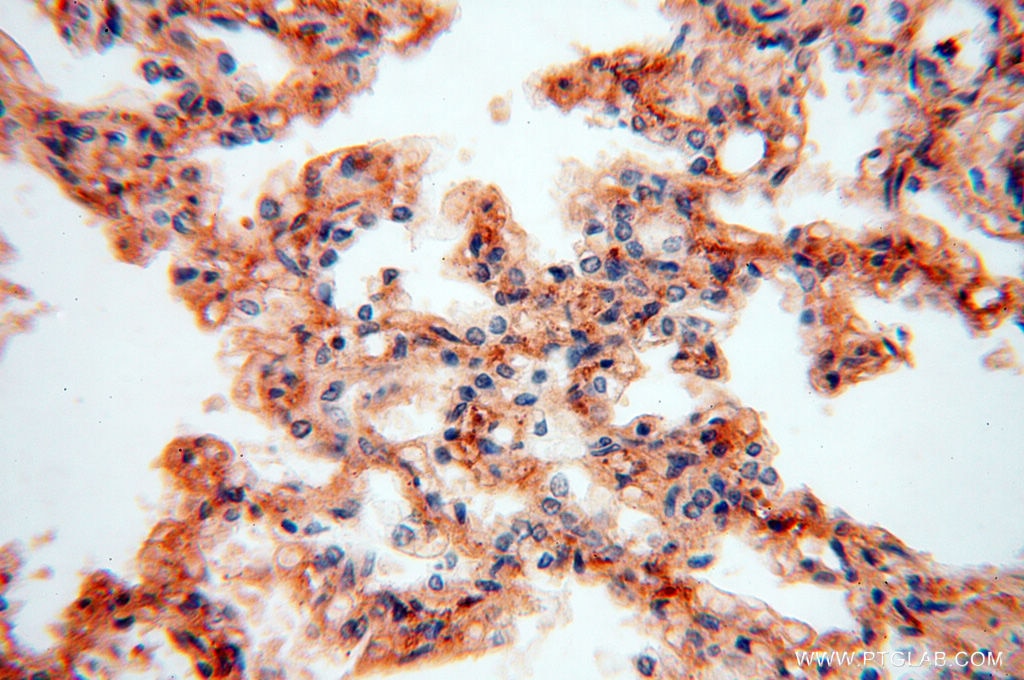 Immunohistochemistry (IHC) staining of human lung tissue using CSNK1A1L Polyclonal antibody (17125-1-AP)