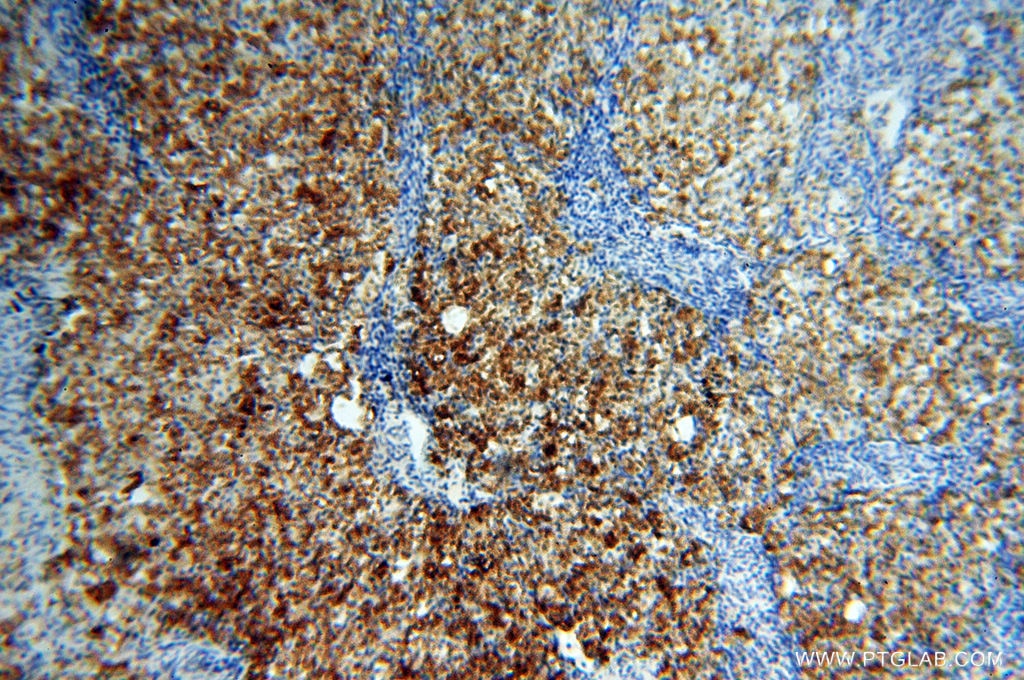 Immunohistochemistry (IHC) staining of human ovary tissue using CSNK1A1L Polyclonal antibody (17125-1-AP)