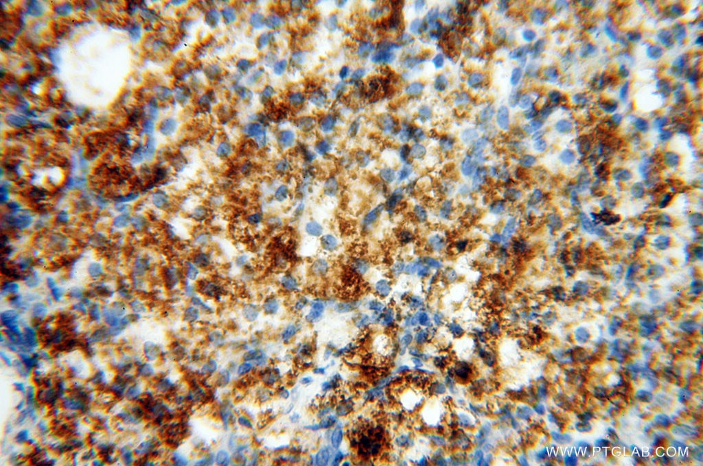 Immunohistochemistry (IHC) staining of human ovary tissue using CSNK1A1L Polyclonal antibody (17125-1-AP)