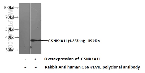 Western Blot (WB) analysis of Transfected HEK-293 cells using CSNK1A1L Polyclonal antibody (17125-1-AP)