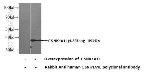 WB analysis of Transfected HEK-293 using 17125-1-AP