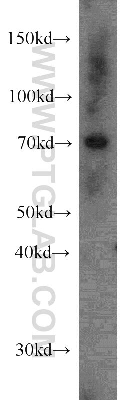Western Blot (WB) analysis of HeLa cells using CSNK1A1L Polyclonal antibody (17125-1-AP)