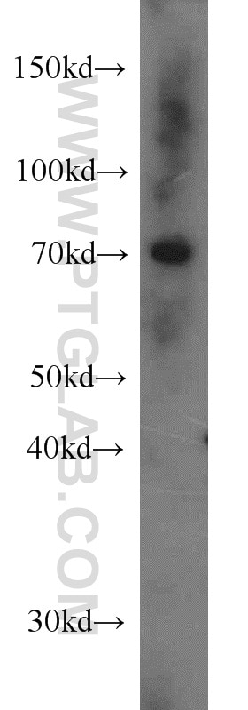 WB analysis of HeLa using 17125-1-AP