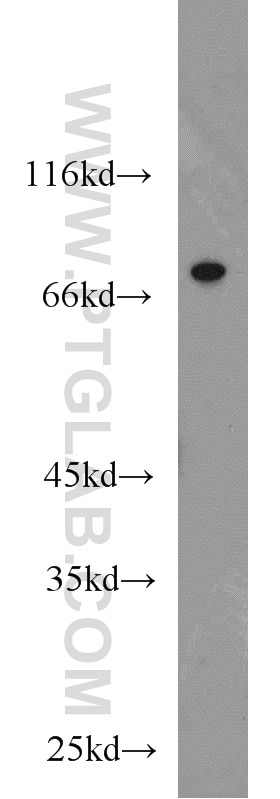 Western Blot (WB) analysis of HeLa cells using CSNK1A1L Polyclonal antibody (17125-1-AP)