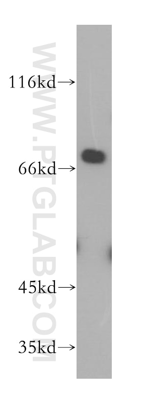 Western Blot (WB) analysis of HeLa cells using CSNK1A1L Polyclonal antibody (17125-1-AP)