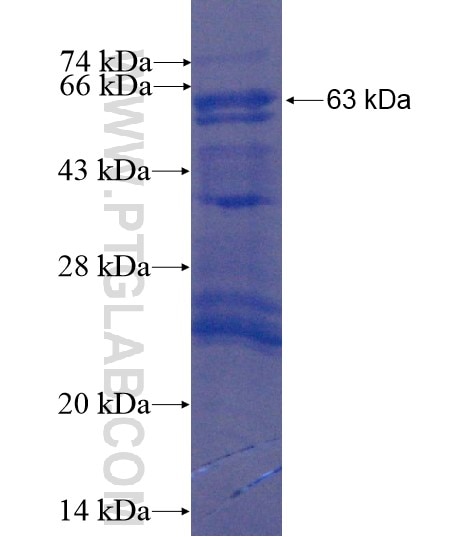 CSNK1A1L fusion protein Ag10814 SDS-PAGE